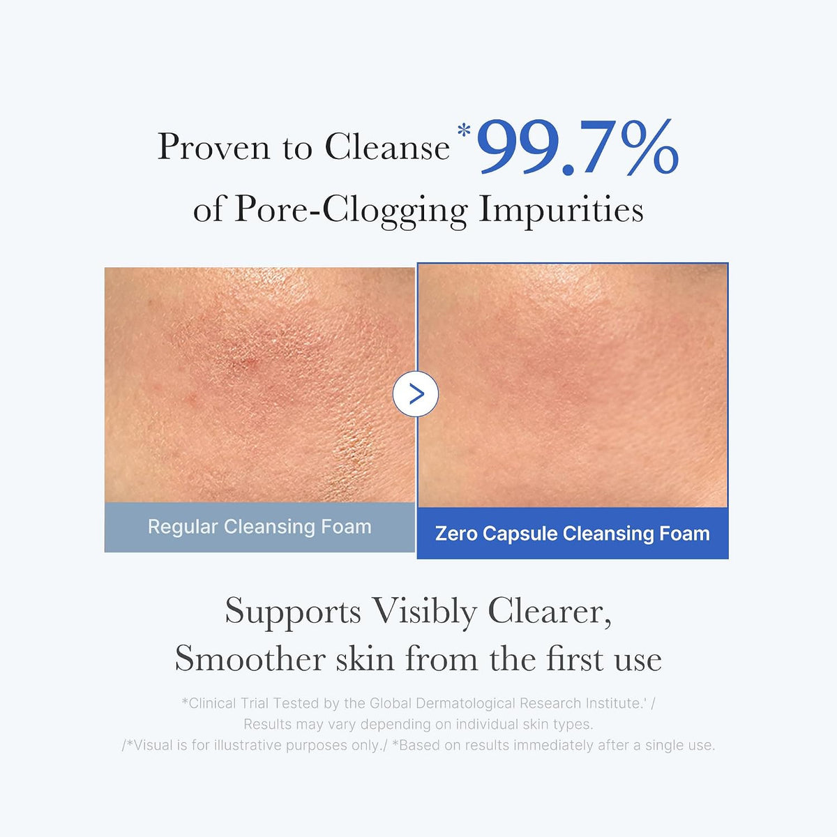 medicube Facial Cleanser Zero Pore Capsule Foam Cleanser
