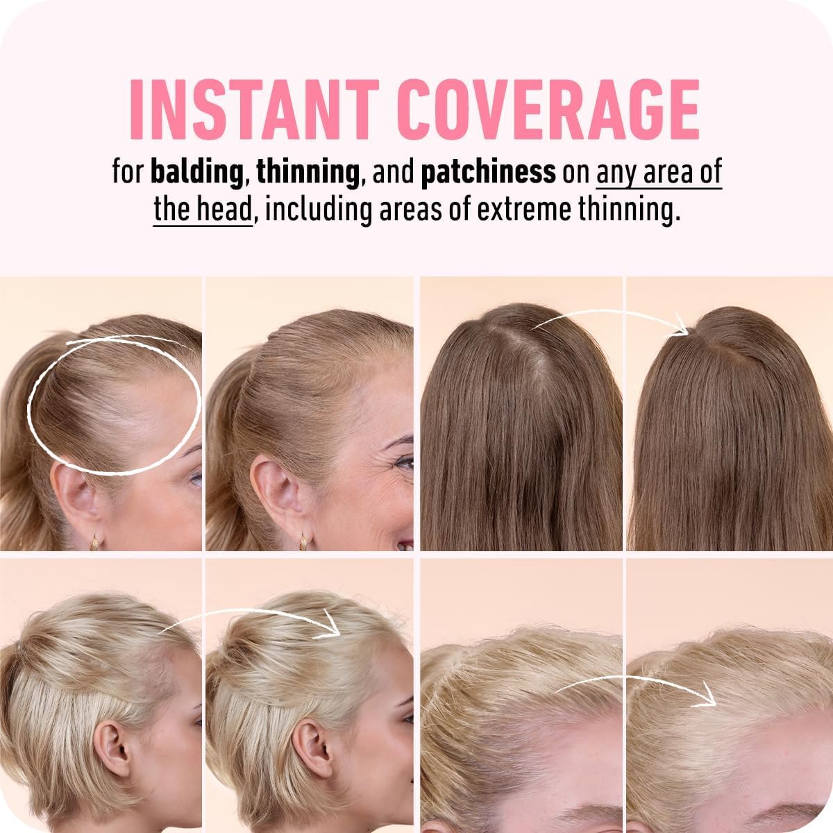 Boldify Hairline Powder, Root Touch Up Hair Color Dark Brown 4g