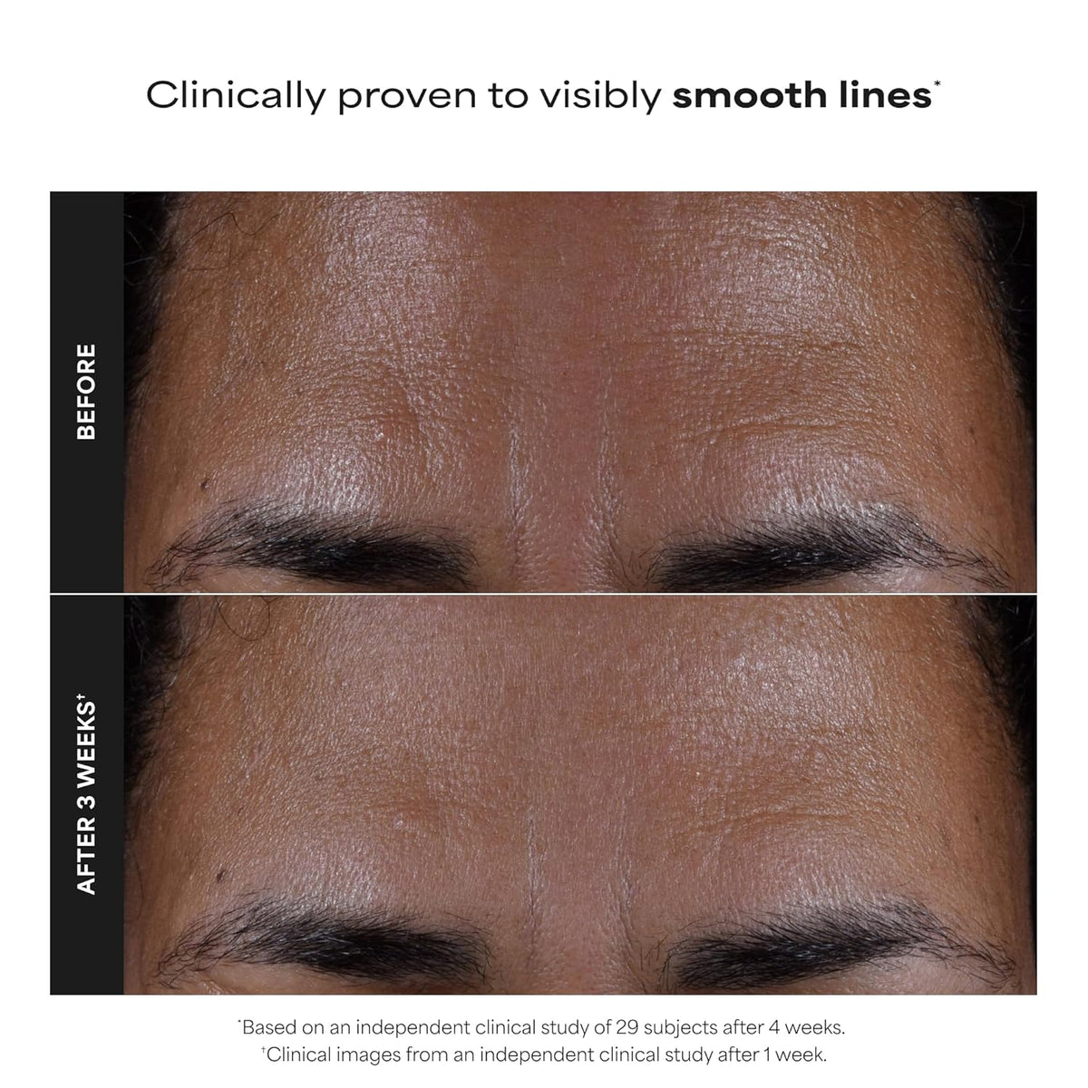 Paula's Choice SKIN PERFECTING 2% BHA Liquid Leave-On Exfoliant