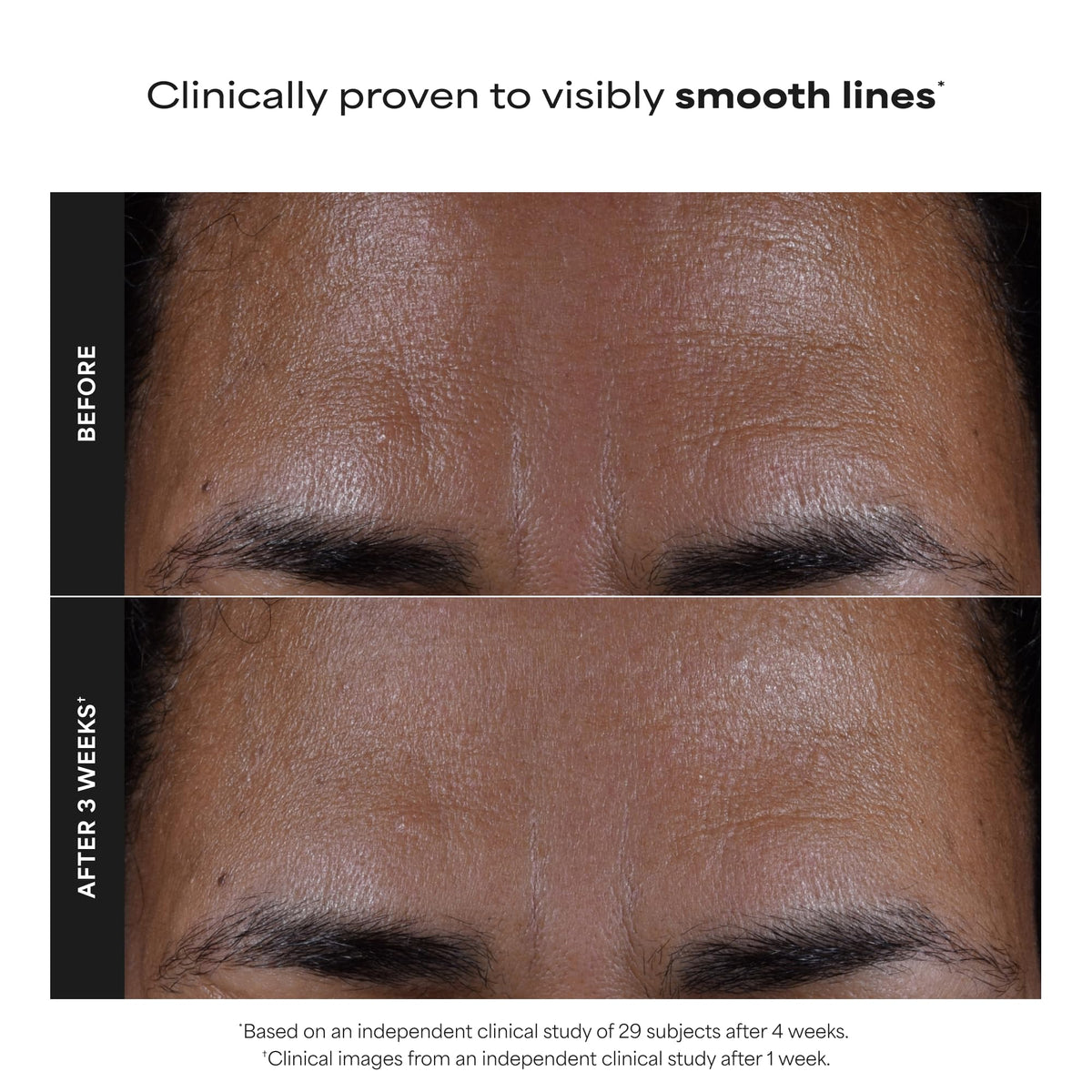 Paula's Choice SKIN PERFECTING 2% BHA Liquid Leave-On Exfoliant